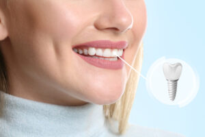 Young woman with implanted teeth on color background, closeup