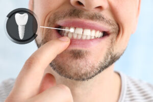 how long do dental implants take